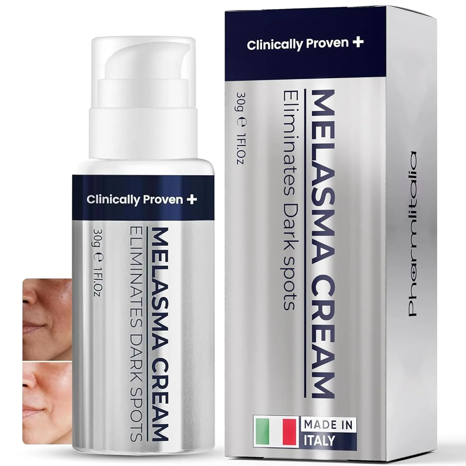 Melasma Treatment for Face - Melasma Cream & Age Spot Remover for Skin Discoloration, Post-Blemish Marks, Scars & Spots | Dark Spot Remover for Face & Body