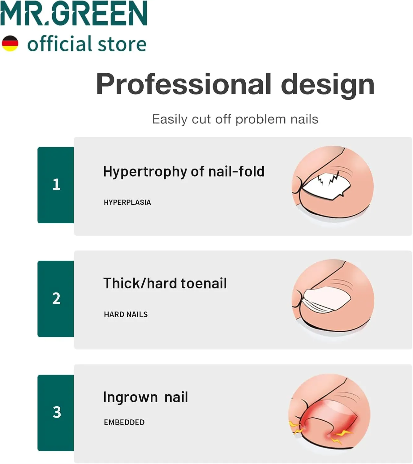MR.GREEN Toenail Clippers Stainless Steel Ingrown Nail Cutter Thick and Hard Nails Pedicure Manicure Tools (Green Nail Remover)
